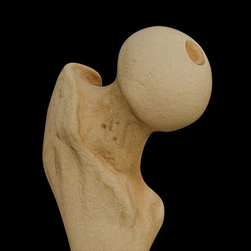 Femur
