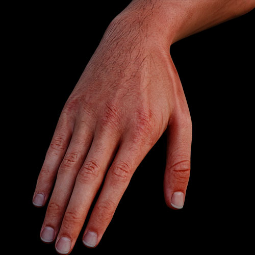 Hand Surface Anatomy